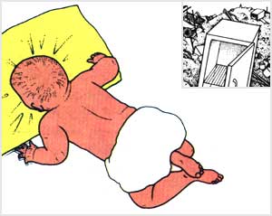 ممکن است بر اثر قرار گرفتن صورت کودک روى باليش يا گير کردن در يخچال قفل شده دچار اين نوع خفگى بشود.
