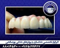 دندانسازی در تهران