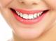 تراشیدن دندان،فوائد تراشیدن دندان،مضرات تراشیدن دندان،مقاله درباره تراشیدن دندان،مقاله در مورد تراشیدن دندان،تراشیدن دندان برای زیبایی،زیبایی دهان و دندان،توصیه های پزشکی،مشکلات دهان و وندان،ناراحتی های دهان و دندان،دندانپزشکی،کامپوزیت دندانپزشکی،