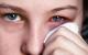 عفونت چشمی،علائم عفونت چشمی،درمان عفونت چشمی،مقاله درباره عفونت چشمی،مقاله در مورد عفونت چشمی،مقاله،توصیه عای پزشکی،چشم،مقاله درباره چشم،مقاله در مورد بیماری های چشمی،محافظت از چشم،سلامت چشم