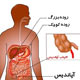 همه چیز درباره «آپاندیس»