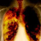 Lungs extraordinary things you are doing