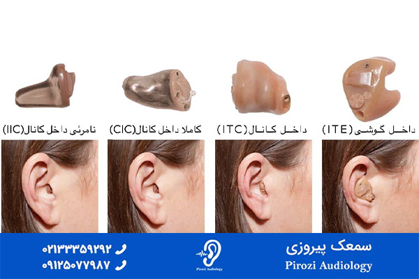 10 سوال رایج سمعک و شنوایی