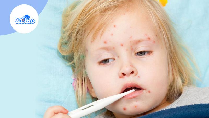 کودکی که دچار اثرات پوستی مننژیت شده است.